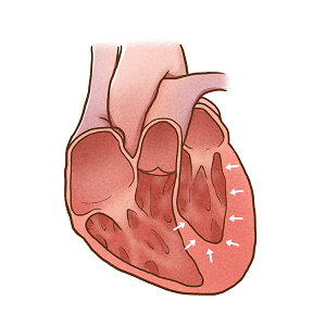 1654534011512985.png 攝圖網(wǎng)_401796677_舒張性心力衰竭(企業(yè)商用).png