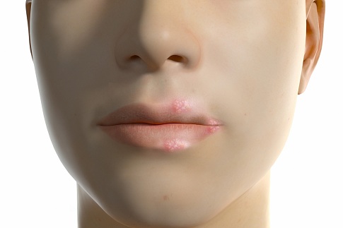 1654789066797713.jpg 攝圖網(wǎng)_402025796_banner_三維口唇皰疹場景(企業(yè)商用).jpg