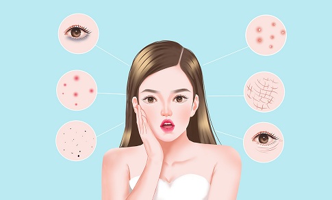 1657121324999863.jpg 攝圖網_401773255_女性皮膚問題插畫(企業商用).jpg