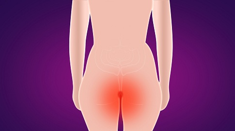 1658162401698036.jpg 攝圖網_400082098_banner_痔瘡(企業商用).jpg