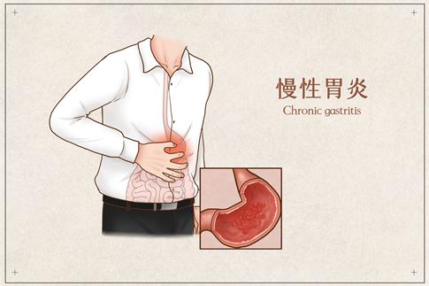 1676661838797928.jpg 攝圖網_401789711_banner_慢性胃炎醫療插畫(企業商用).jpg