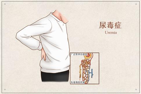 1684803825225917.jpg 攝圖網(wǎng)_401794004_banner_尿毒癥醫(yī)療插畫(huà)(企業(yè)商用).jpg