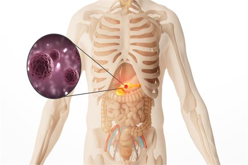 1689835927199225.jpg 攝圖網_401863694_banner_人體胰腺癌場景(企業(yè)商用).jpg