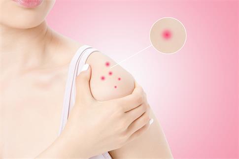 1719644835944143.jpg 攝圖網_500983105_banner_肩部過敏紅腫(企業商用).jpg