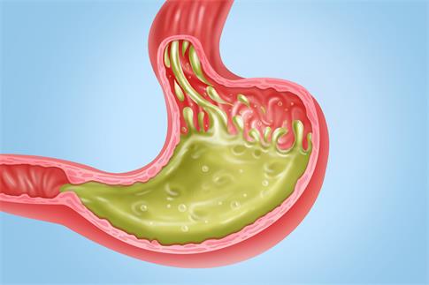 1734394433491464.jpg 攝圖網_401808437_banner_胃反流醫療健康插圖(企業商用).jpg