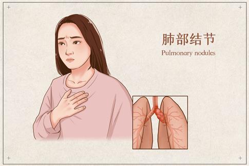 1738973377843258.jpg 攝圖網_401863170_banner_肺部結節醫療插畫(企業商用).jpg