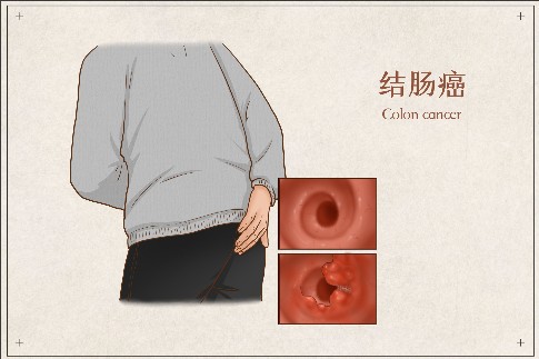 �޸ĳߴ� (1).jpeg